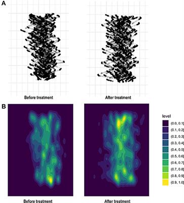 Gait in Benign Paroxysmal Positional Vertigo